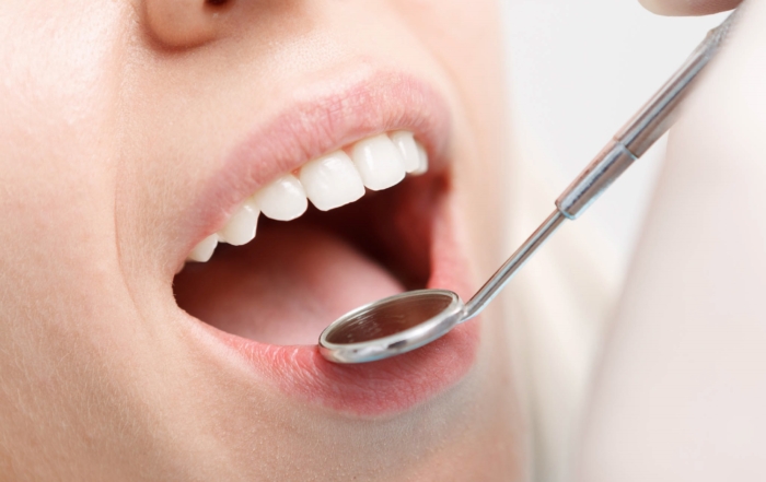 The Benefits Of Tongue Scraping For Oral Health Highland Kitchener Dentist